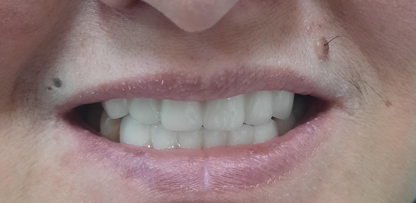 Doksmile