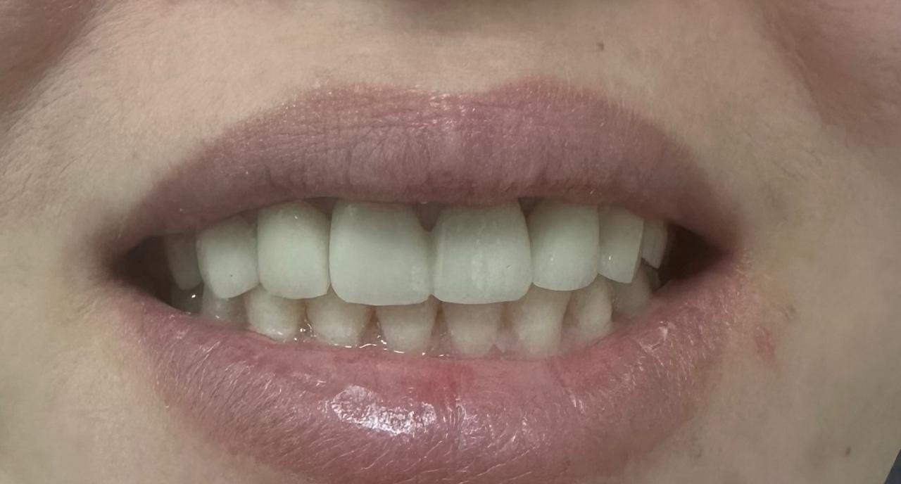 Doksmile