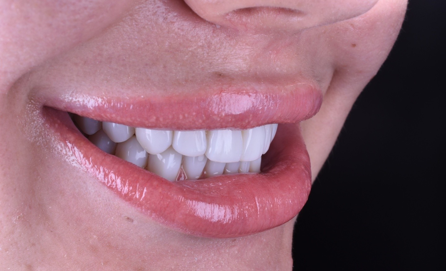 Dental Expert