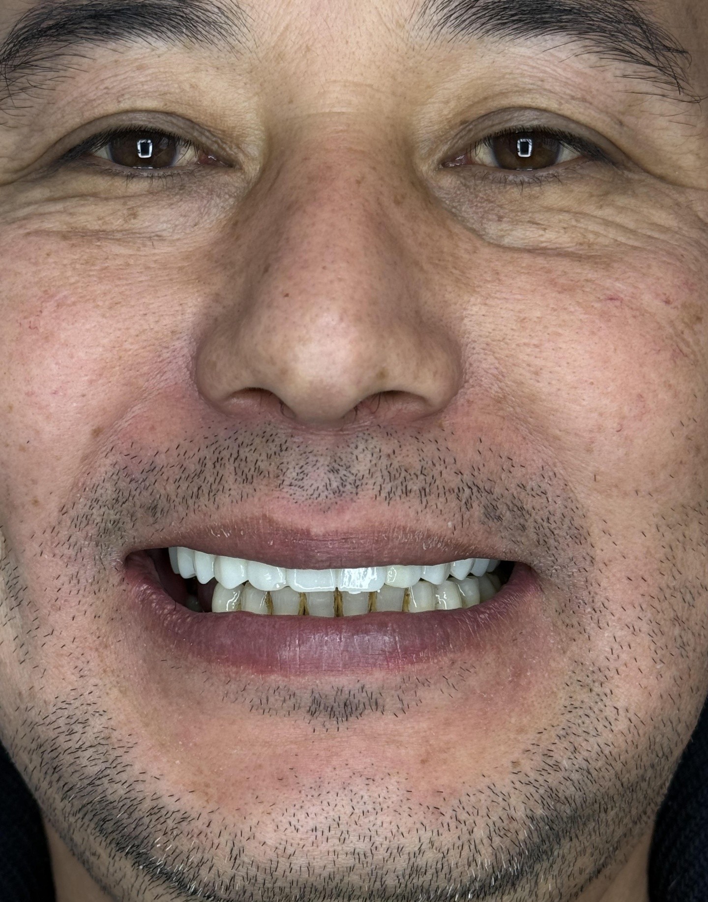7 Dent