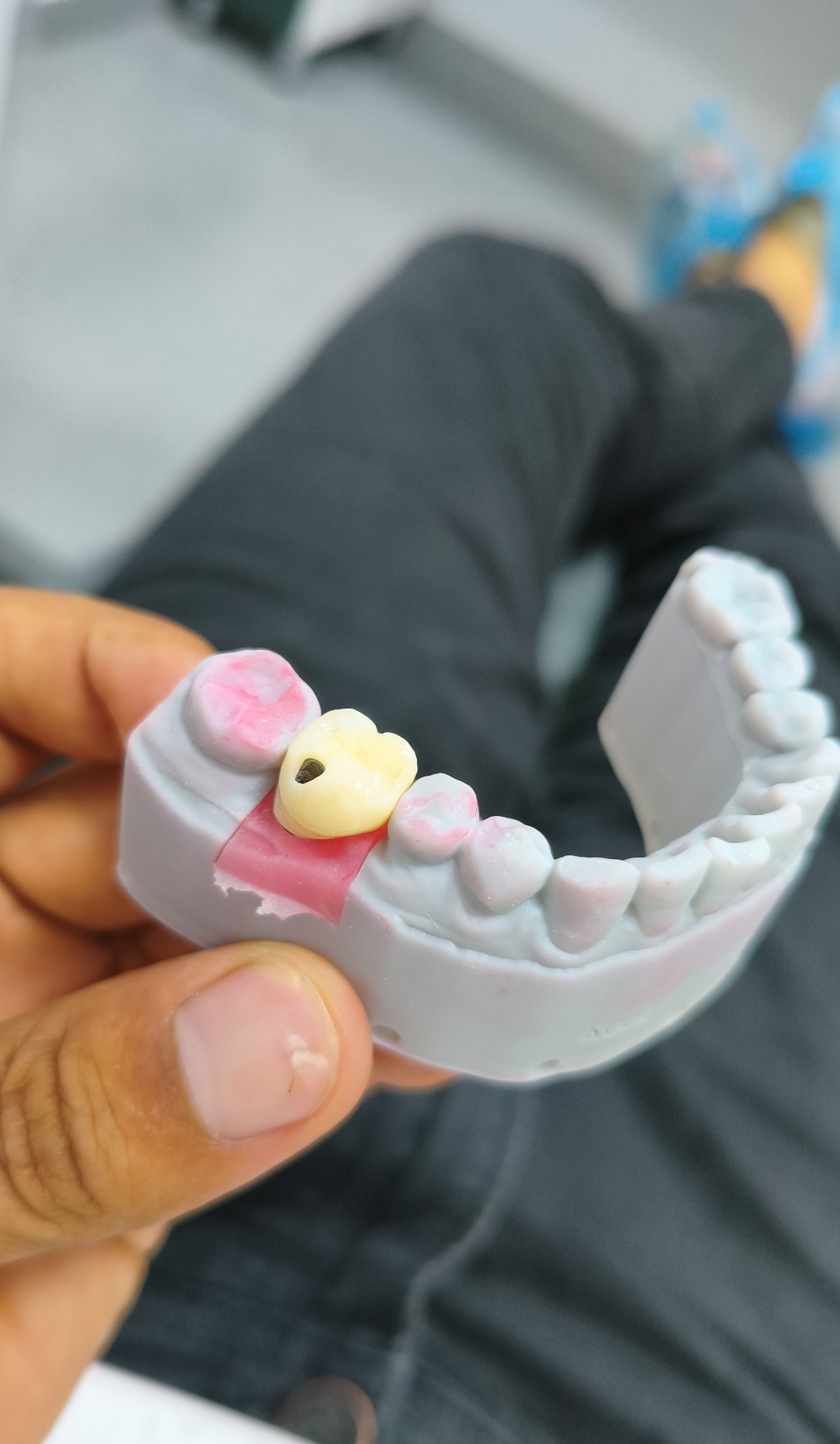 Rich Smile