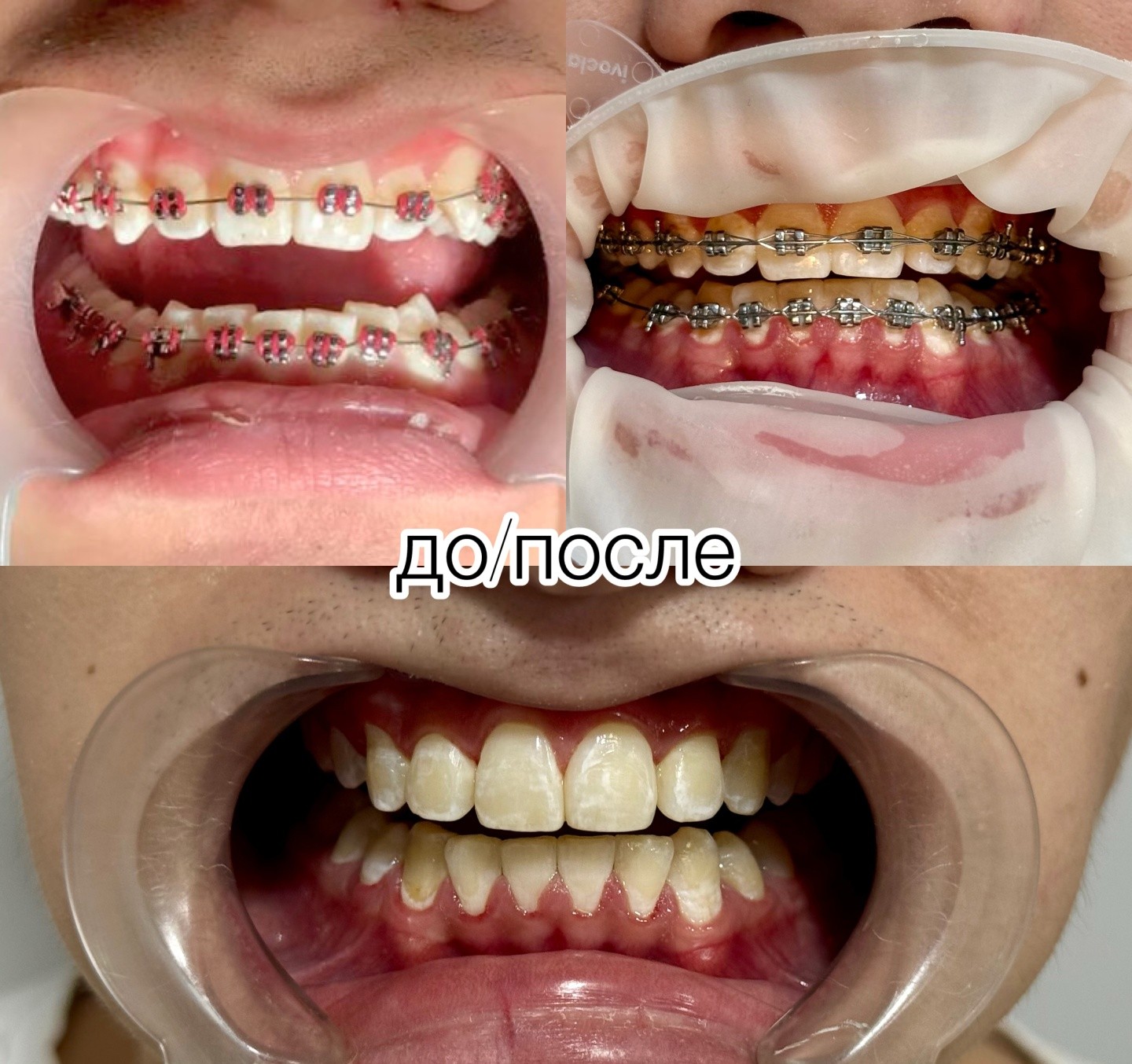 Sali Dent