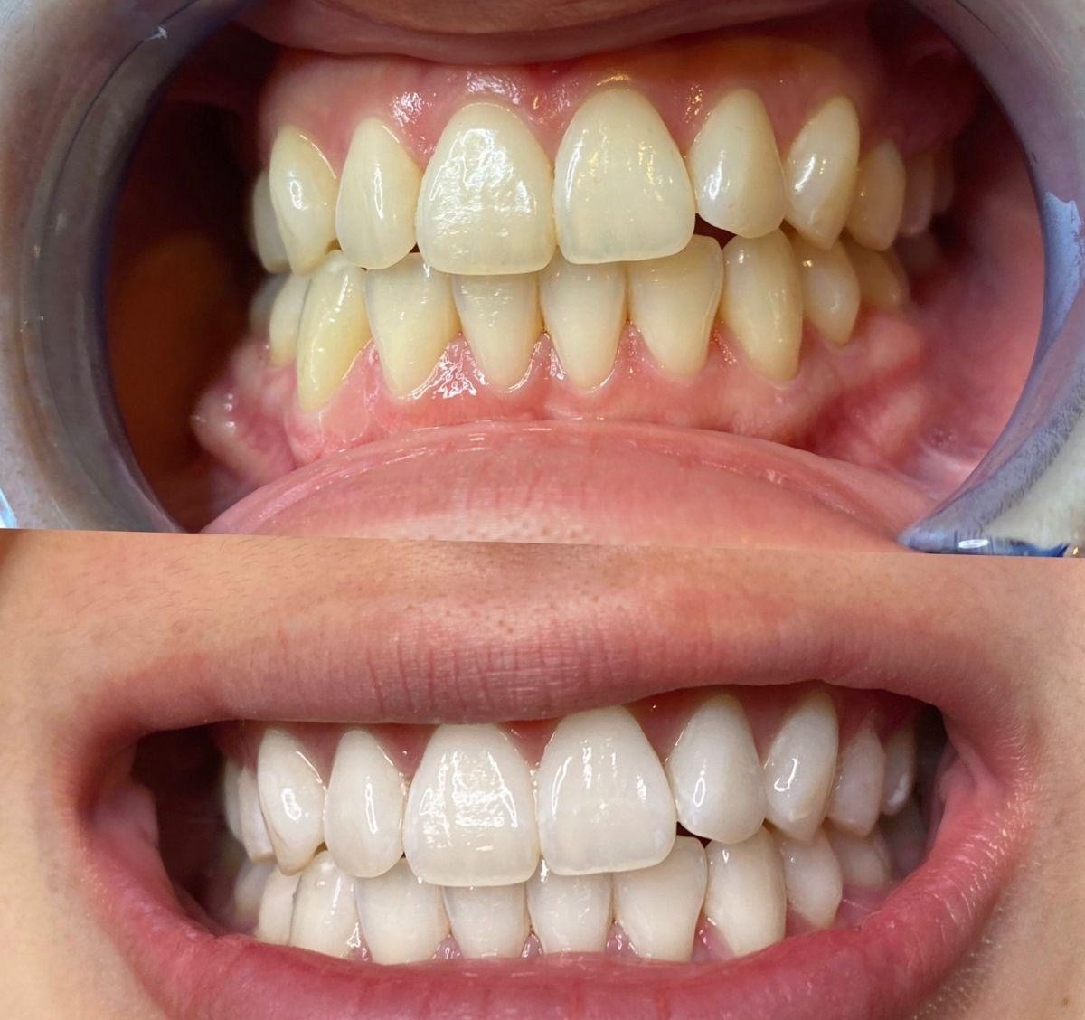 Appaq Dent