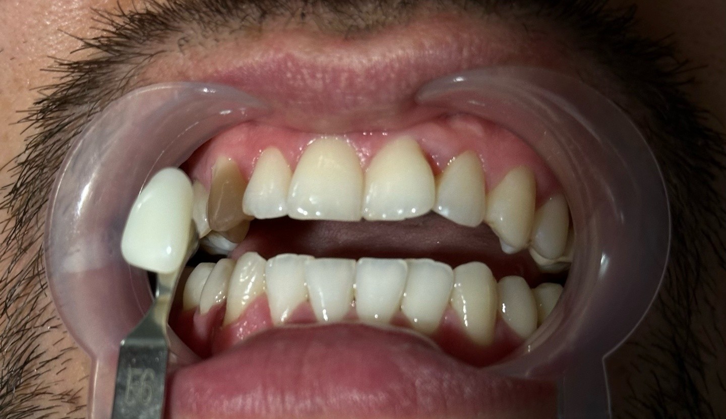 Appaq Dent