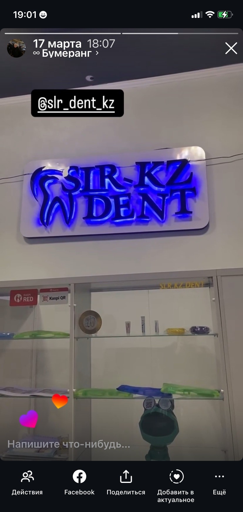 SLR-kz dent