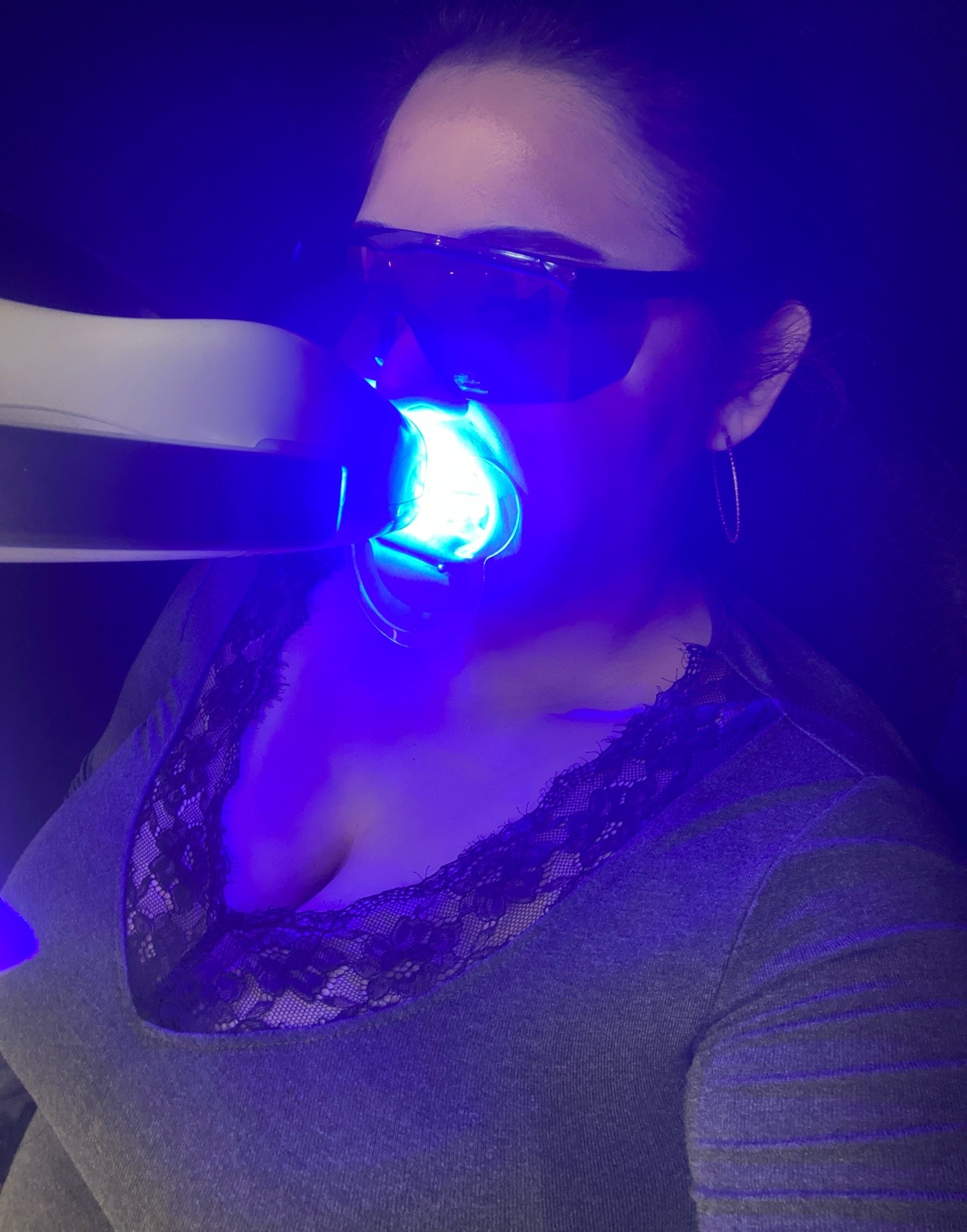 32 whitening room