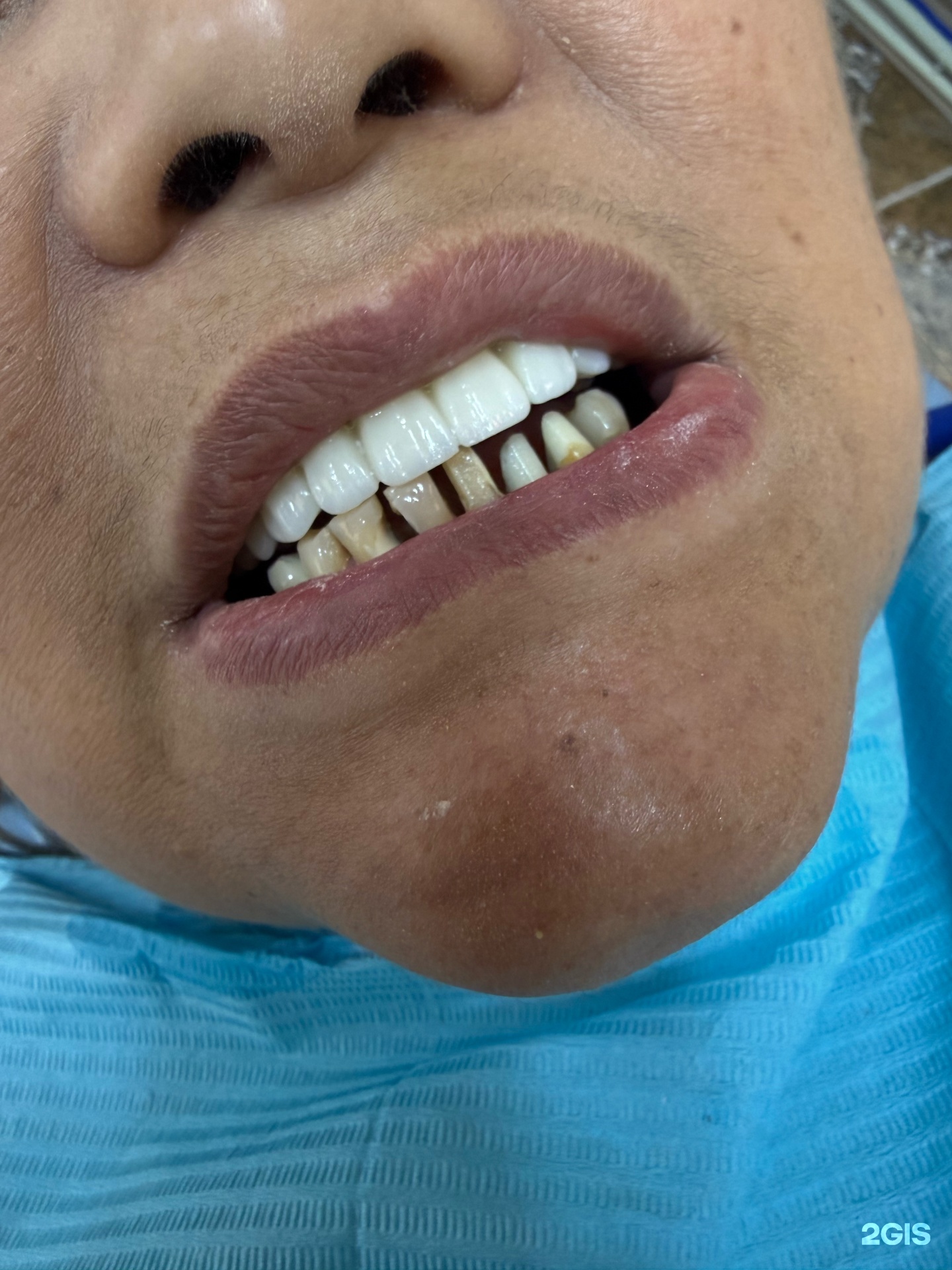 Amire Dent