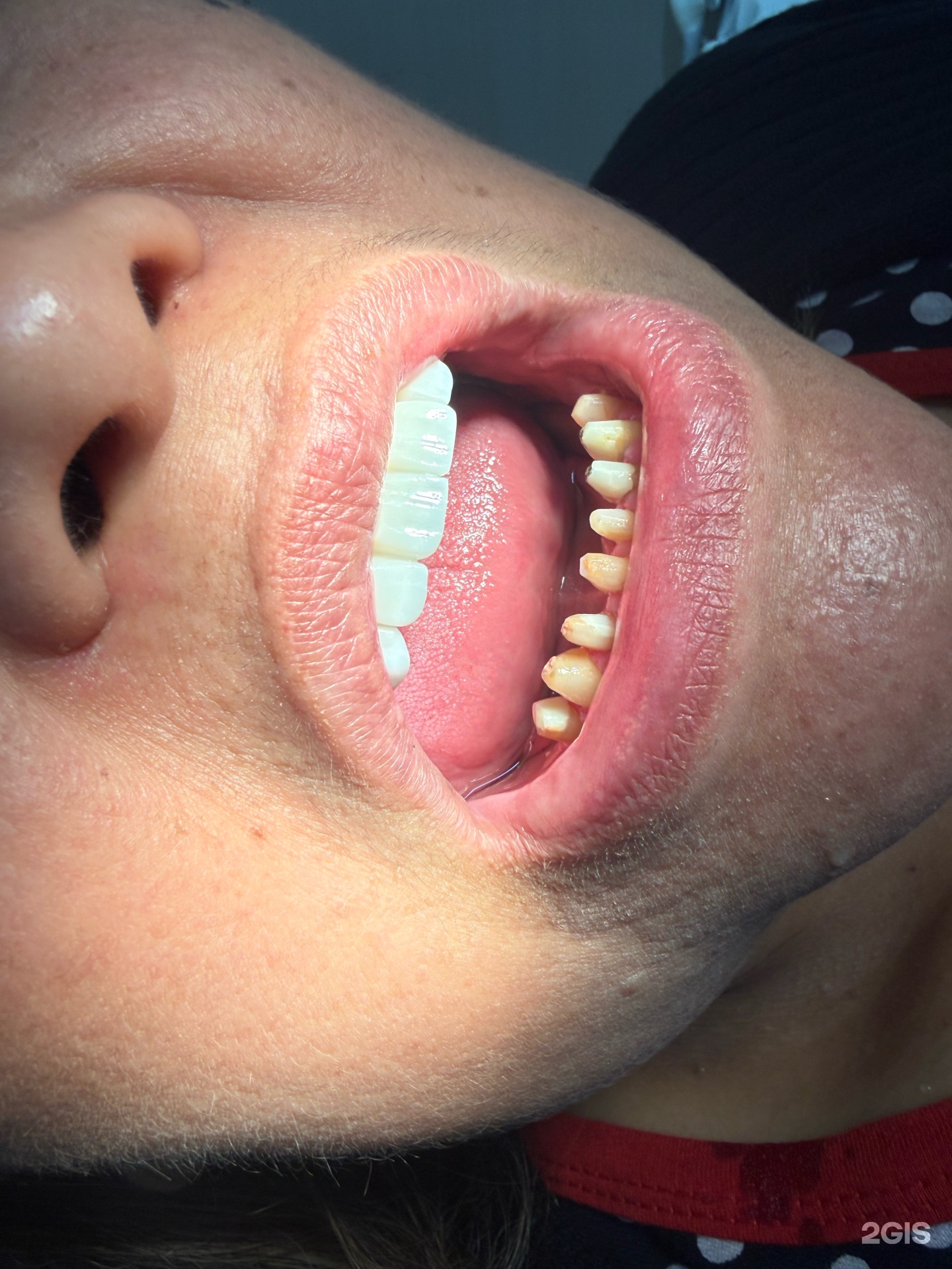 Amire Dent