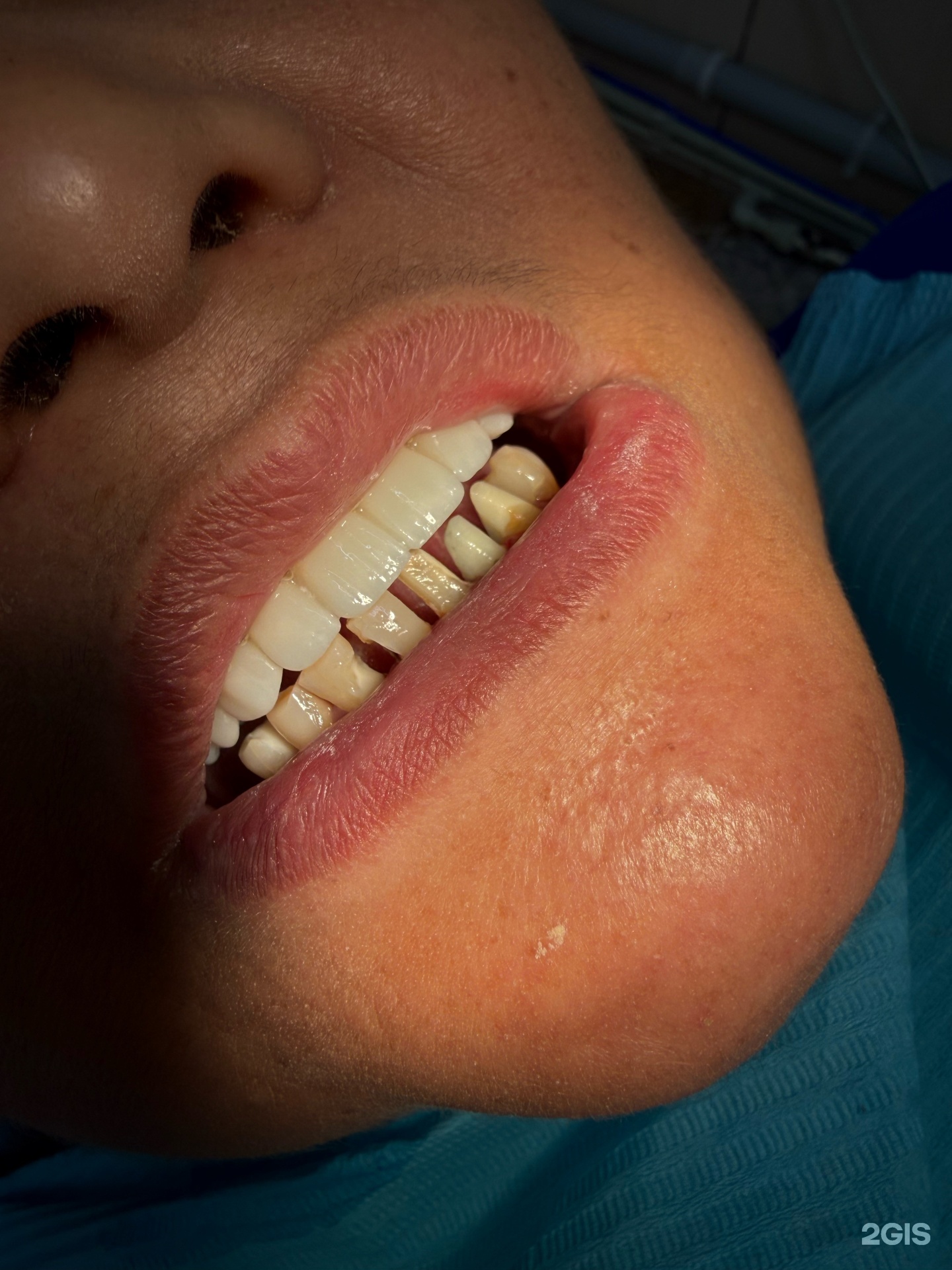Amire Dent