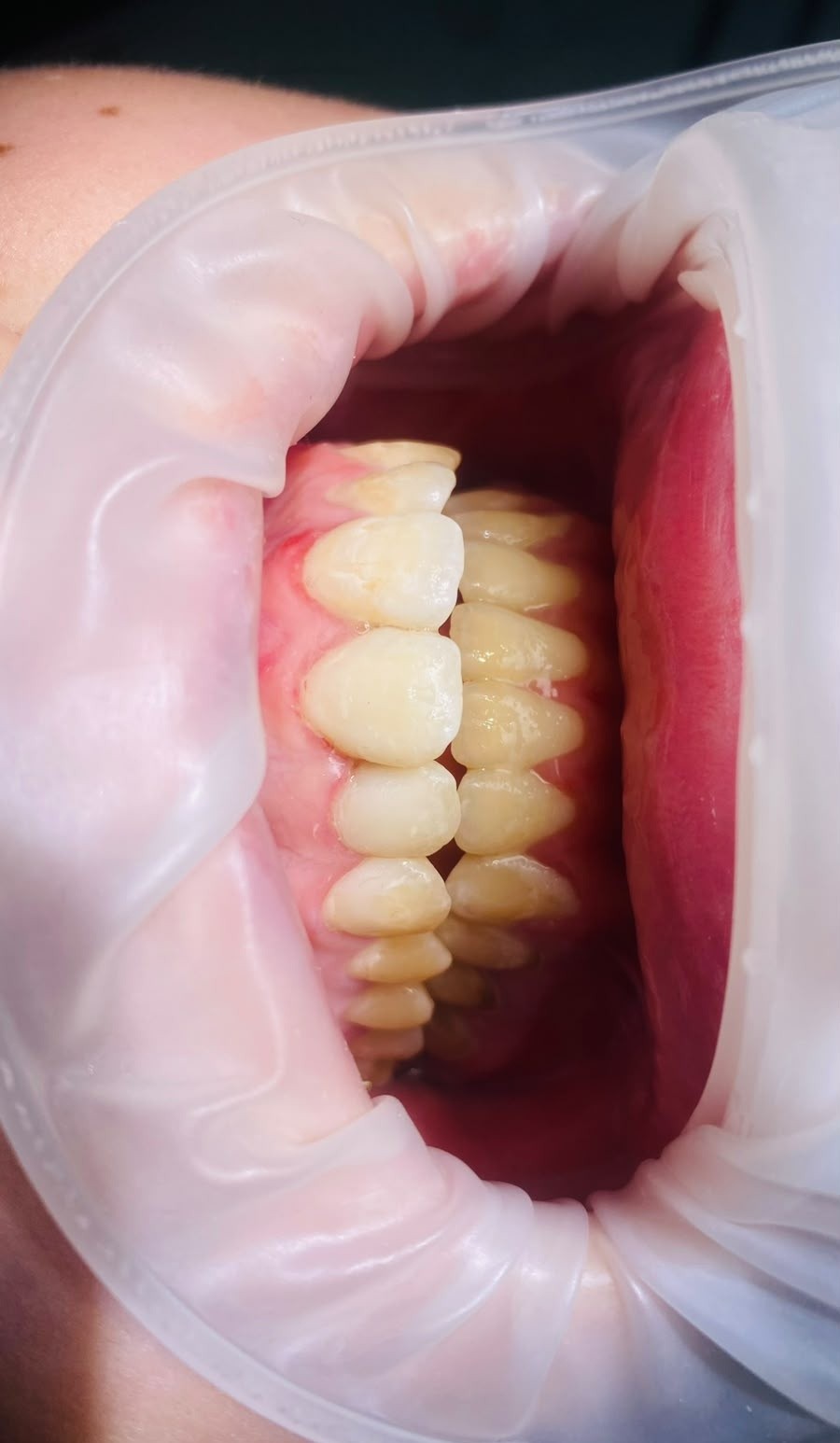 S-Dental
