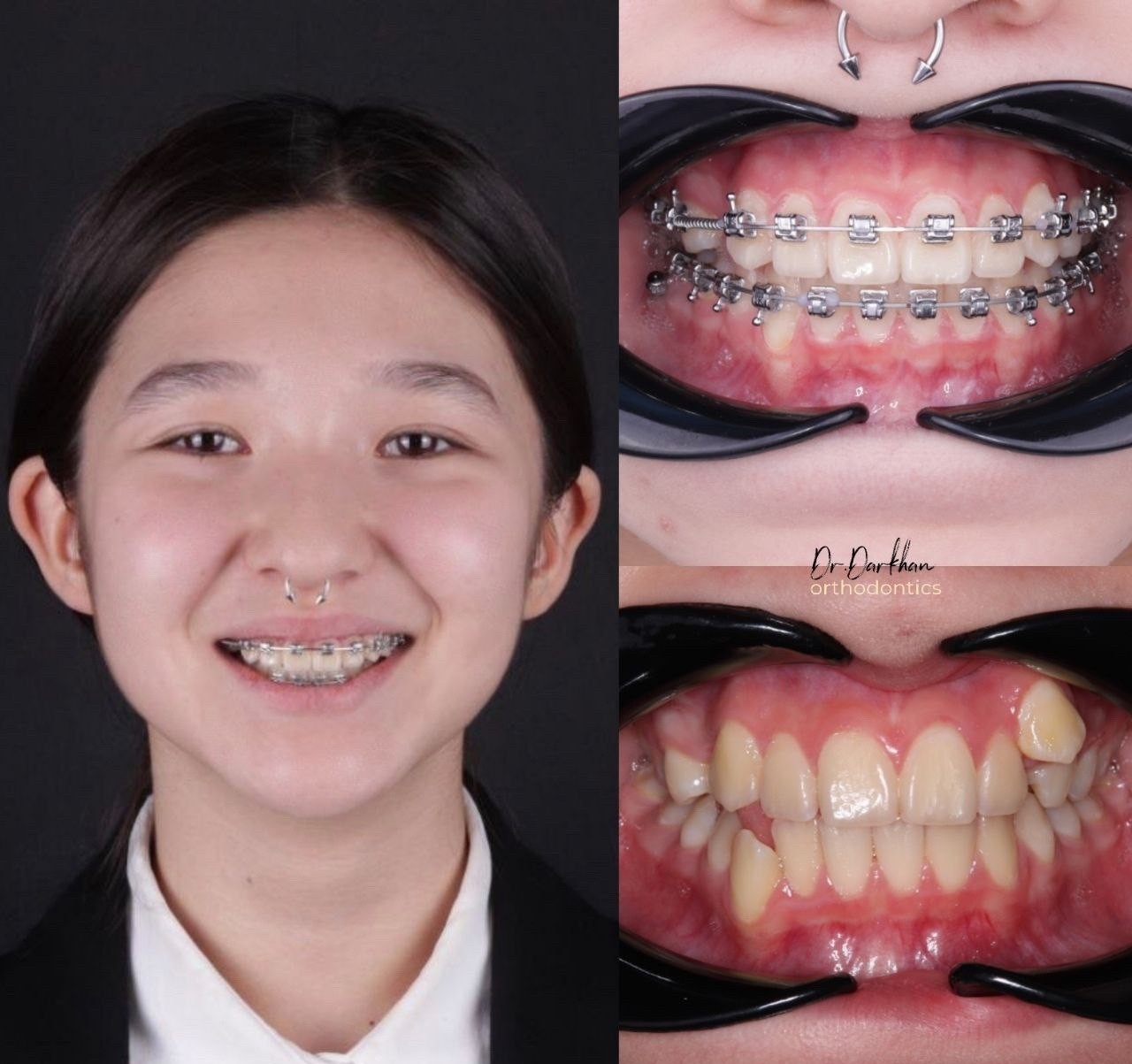 Smile center