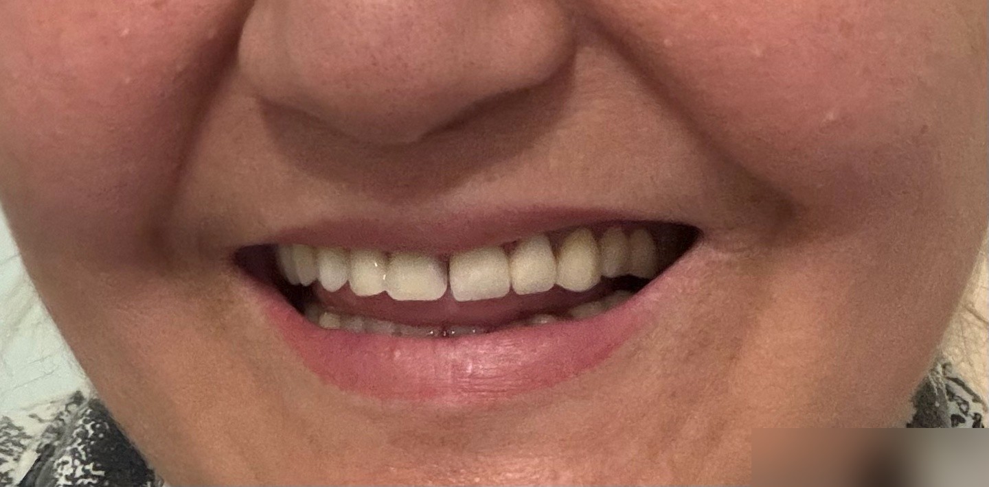 SD dental