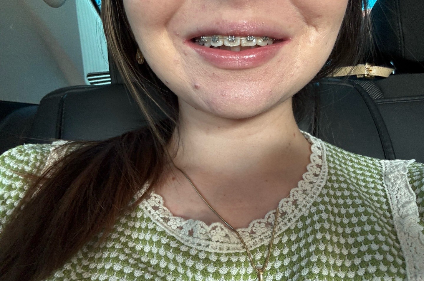 SD dental