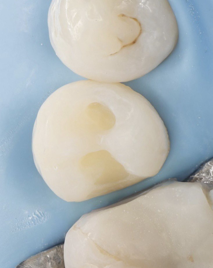 DentPro