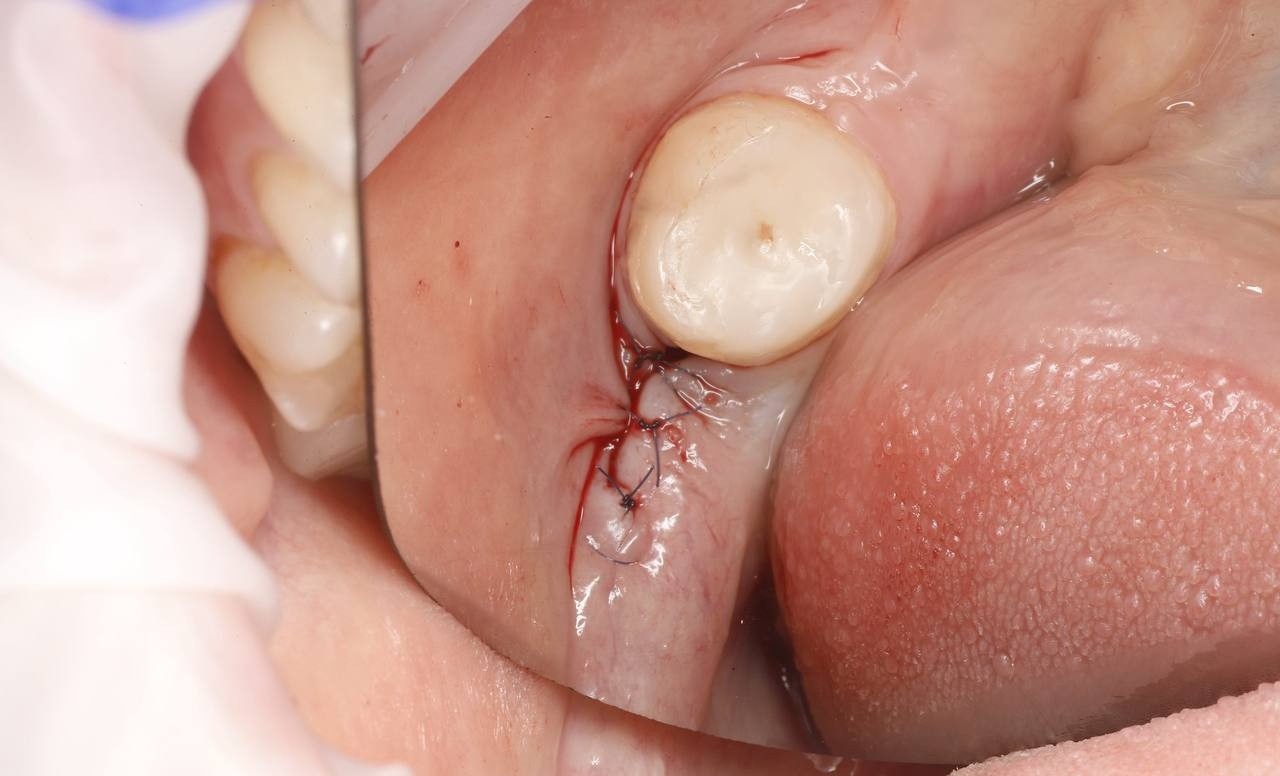 DentPro
