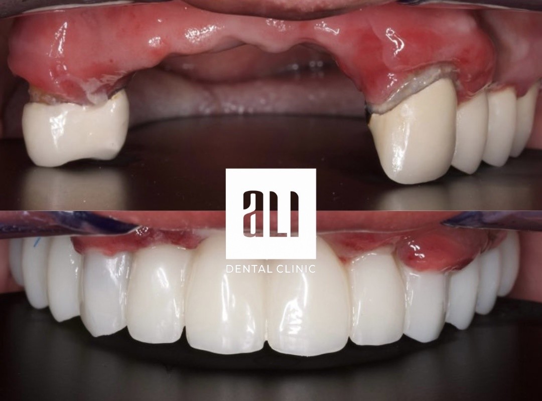 Ali dental clinic