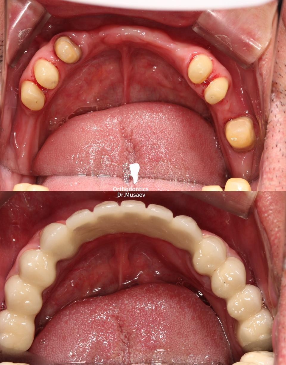 Orthodontics