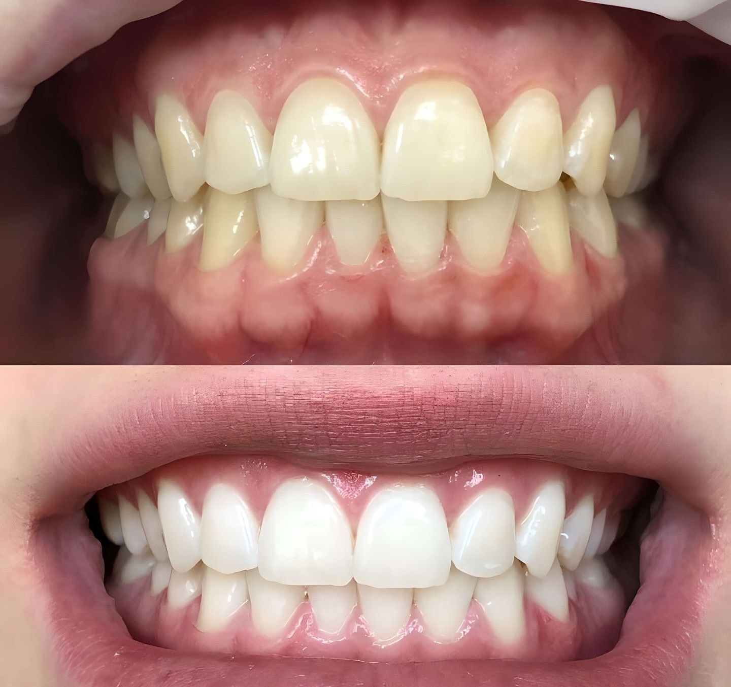 Dental Vision Premium 24/7