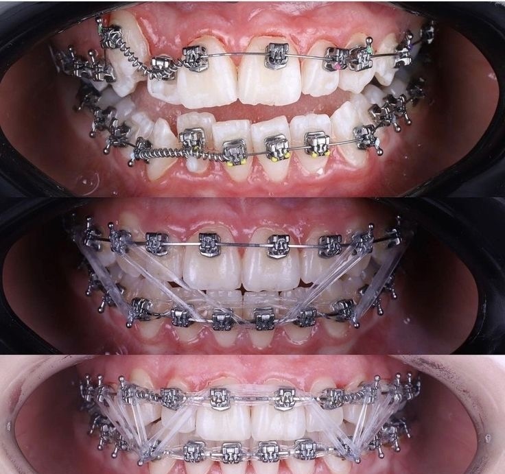 Dental Vision Premium 24/7