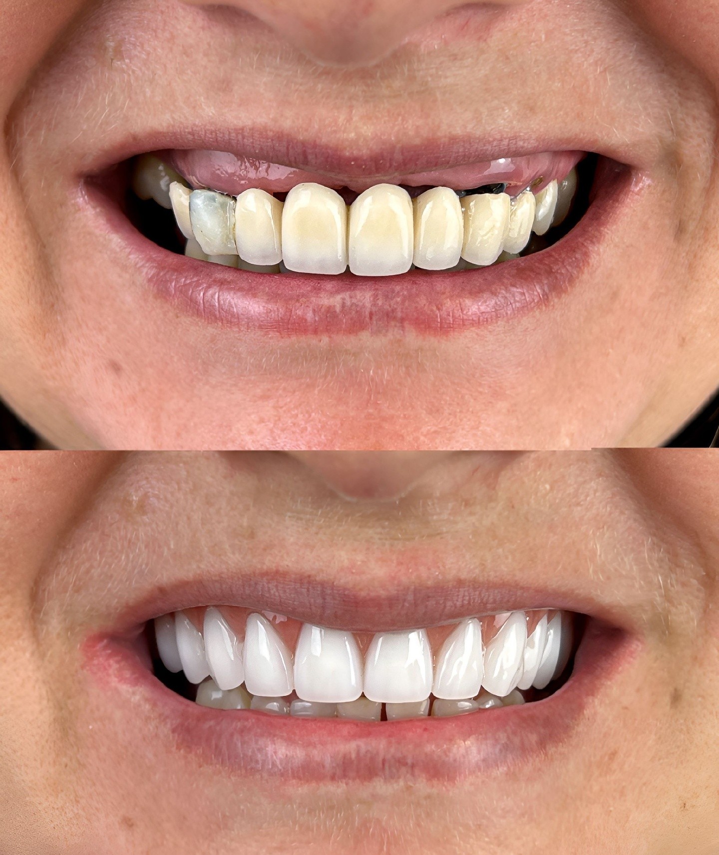 Dental Vision Premium 24/7