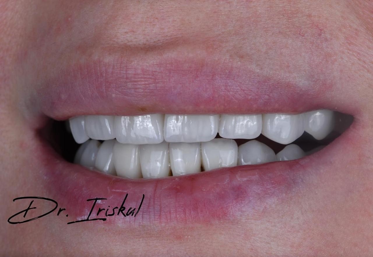 Smile Concept