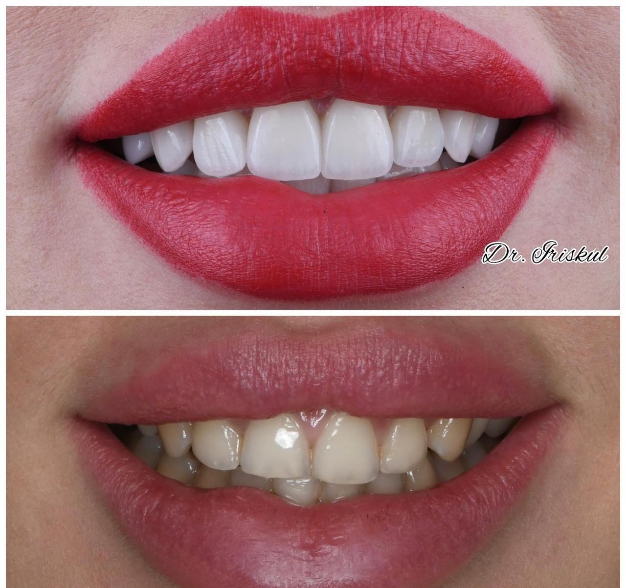 Smile Concept