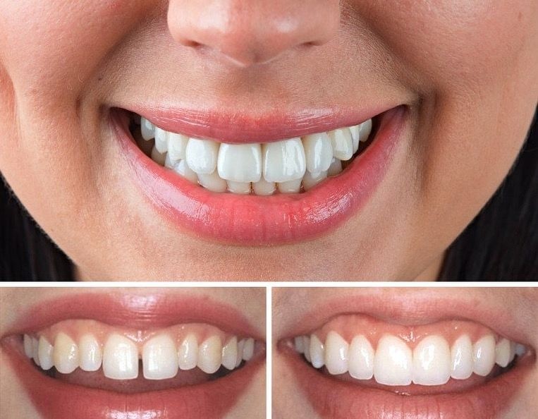 АТМОСФЕРА Dental Center by Dr.Kadyrov